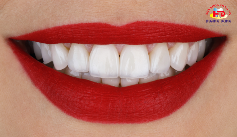 Bọc răng sứ có đau không? Bọc răng sứ ở đâu tại Nghệ An?